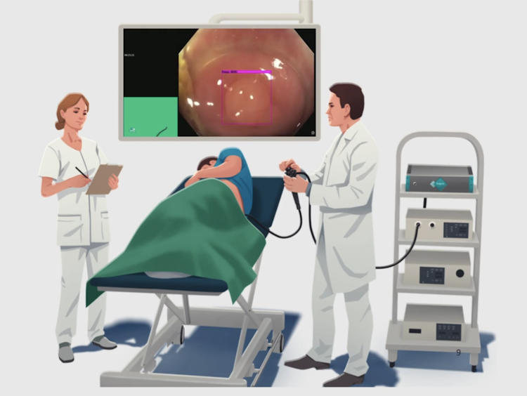 ColoCompare: colonoscopy guidance and AI assisted procedure comparison